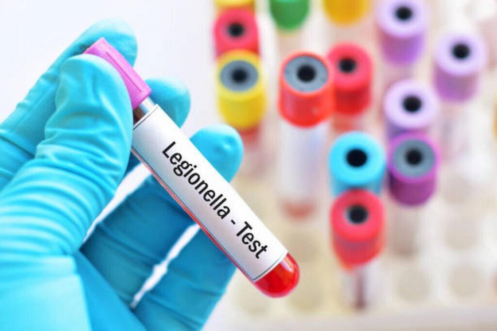Legionella